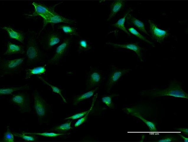 Anti-GALT antibody produced in rabbit