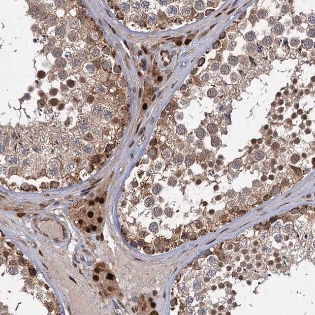 Anti-GAL3ST4 antibody produced in rabbit