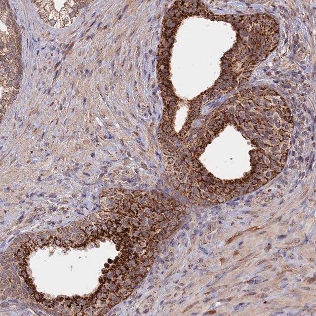 Anti-FAM210B antibody produced in rabbit