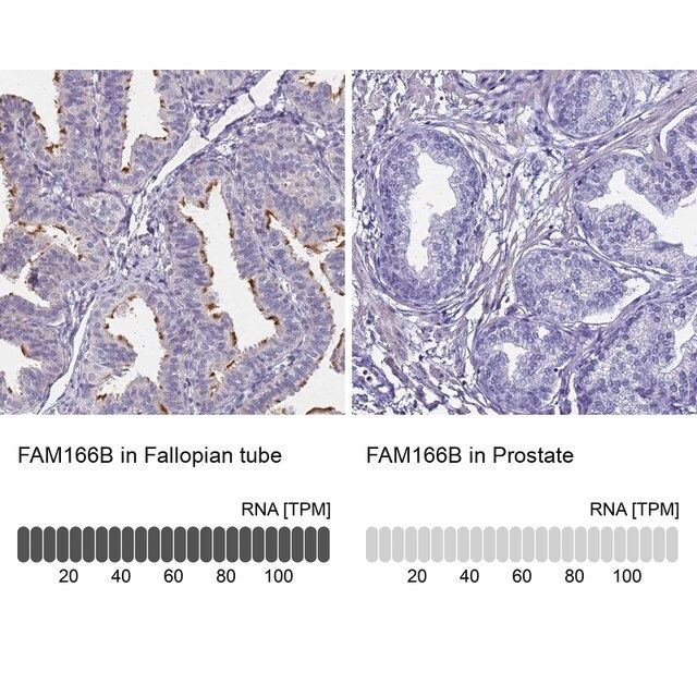 Anti-FAM166B antibody produced in rabbit