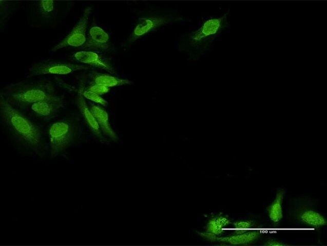 Anti-EPB41L2 antibody produced in rabbit