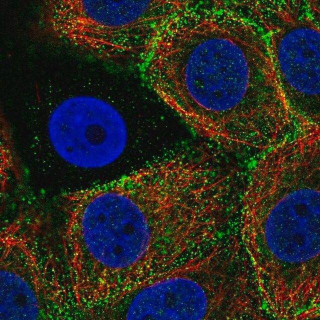 Anti-EPN3 antibody produced in rabbit