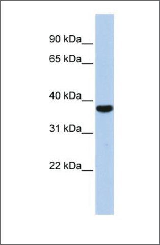 Anti-EXOSC2 antibody produced in rabbit