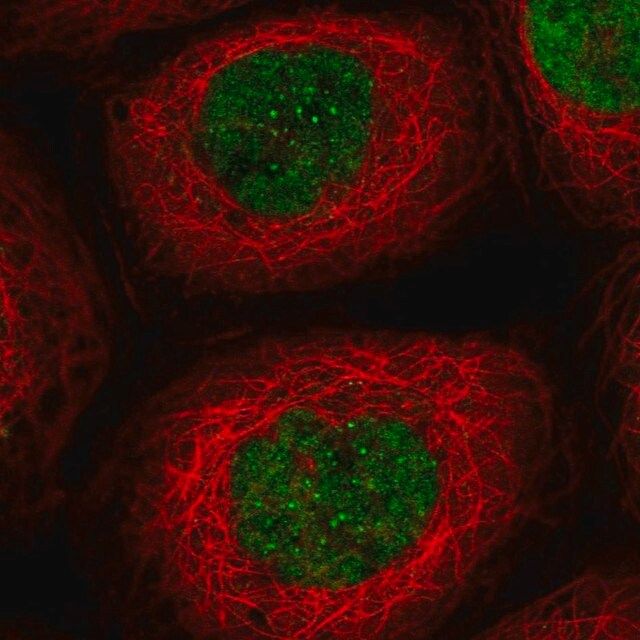 Anti-EXO1 antibody produced in rabbit