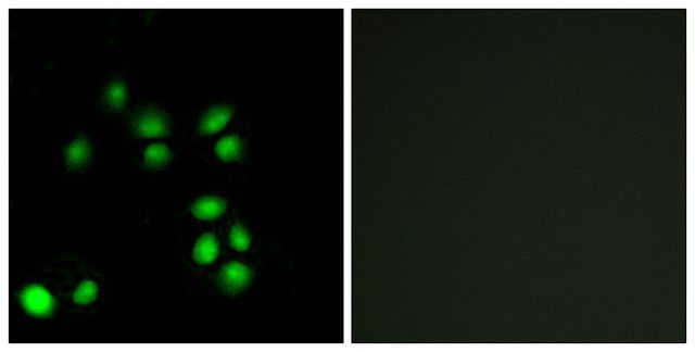 Anti-EXO1 antibody produced in rabbit