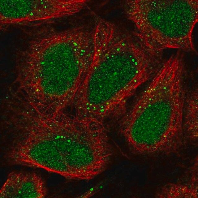 Anti-EXOC6 antibody produced in rabbit