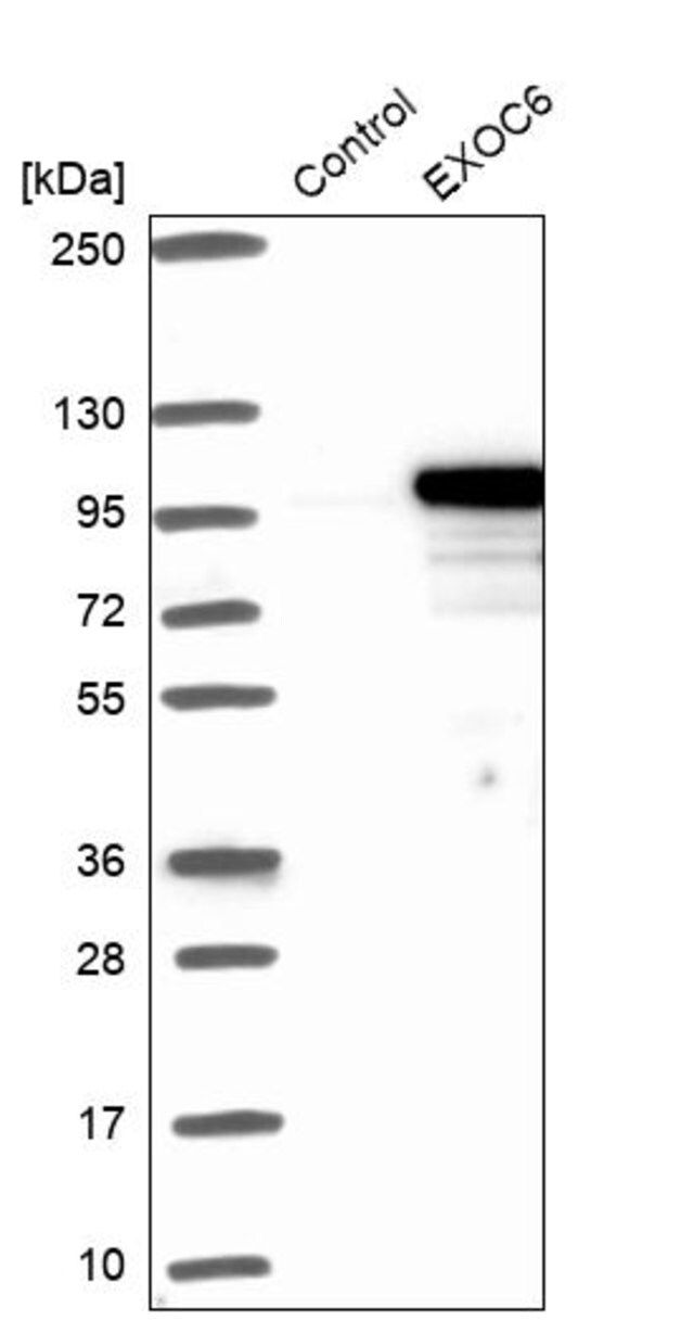 Anti-EXOC6 antibody produced in rabbit