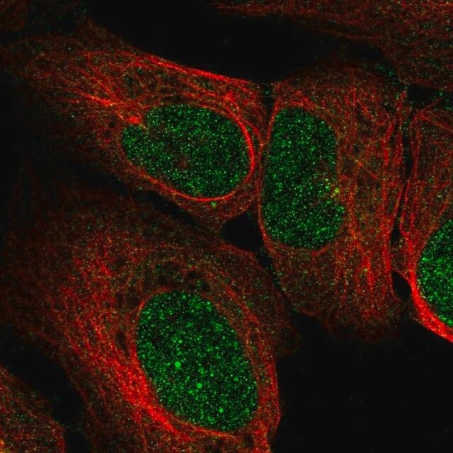 Anti-EXOSC2 antibody produced in rabbit