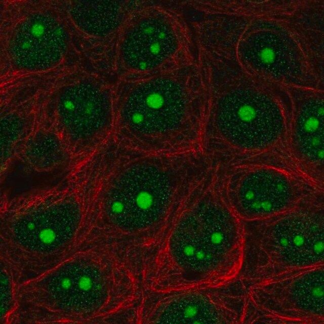 Anti-EXOSC5 antibody produced in rabbit