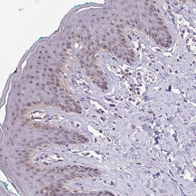 Anti-EXOSC7 antibody produced in rabbit