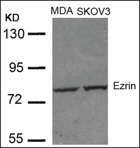 Anti-EZR (Ab-353) antibody produced in rabbit