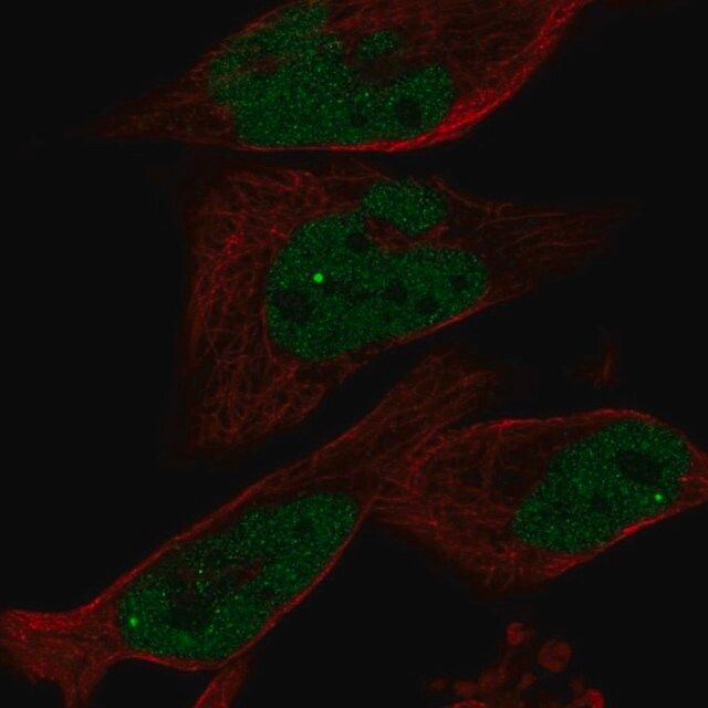 Anti-EYA1 antibody produced in rabbit