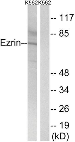 Anti-Ezrin antibody produced in rabbit