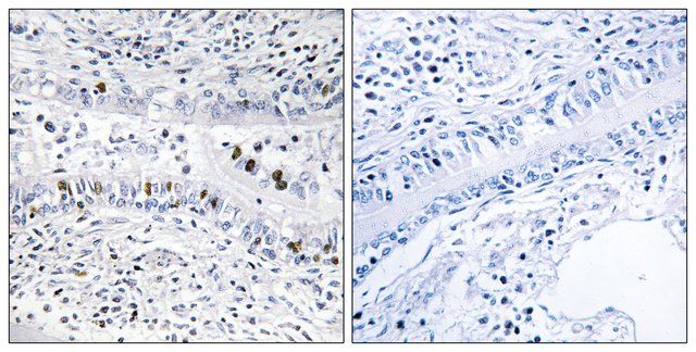 Anti-EZH1 antibody produced in rabbit