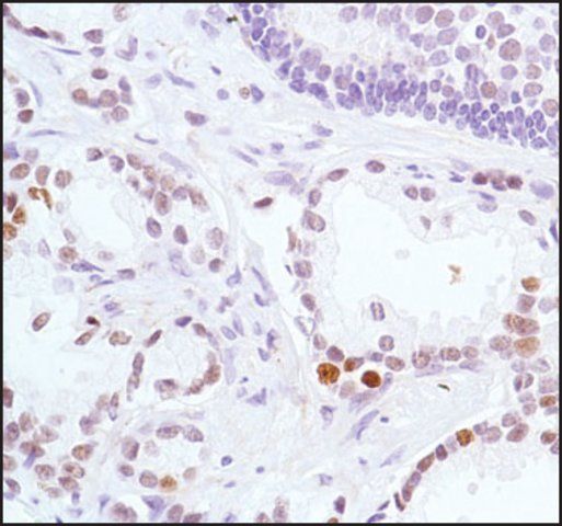 Anti-EZH2 antibody, Rabbit monoclonal