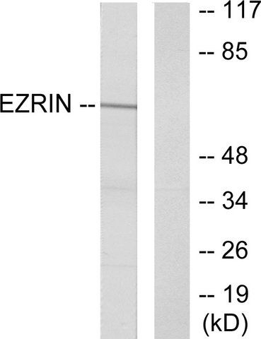 Anti-Ezrin antibody produced in rabbit