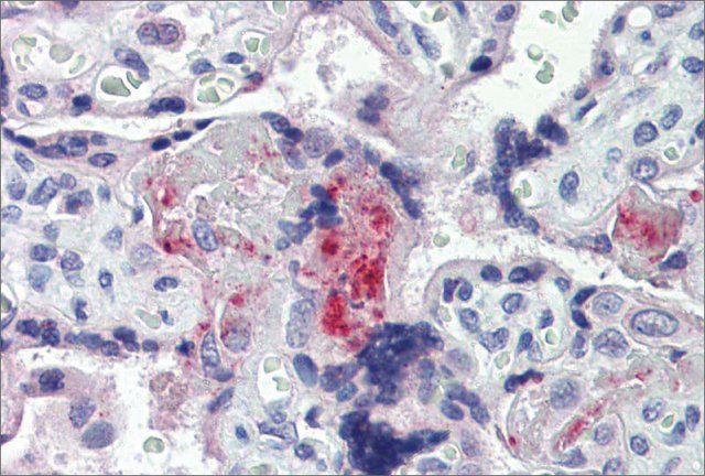 Anti-F2 antibody produced in rabbit