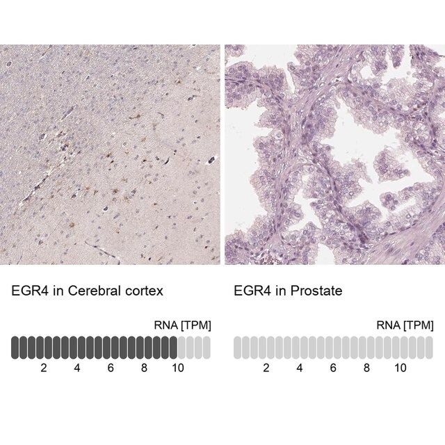 Anti-EGR4 antibody produced in rabbit