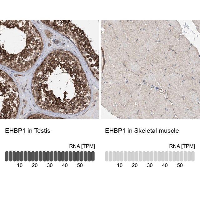 Anti-EHBP1 antibody produced in rabbit