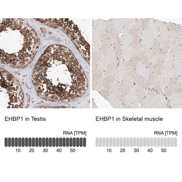 Anti-EHBP1 antibody produced in rabbit