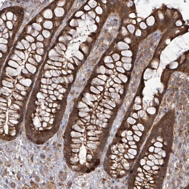 Anti-EIF3C antibody produced in rabbit