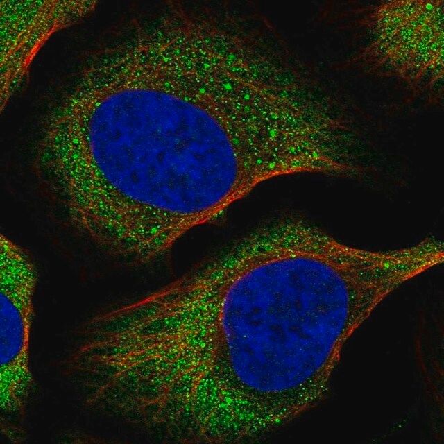 Anti-eIF4E antibody produced in rabbit