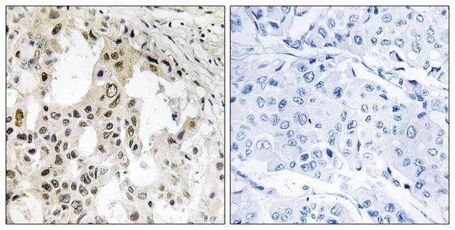 Anti-EIF3D antibody produced in rabbit