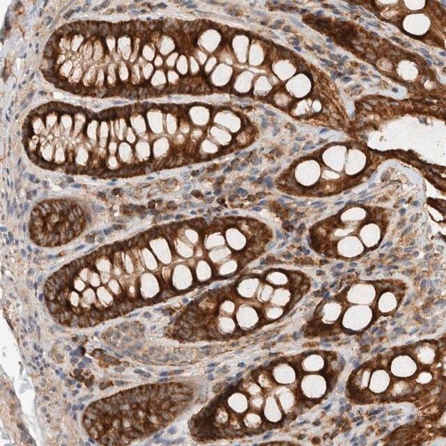 Anti-EIF2B3 antibody produced in rabbit