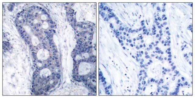 Anti-eIF4E antibody produced in rabbit