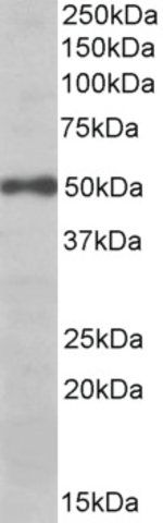 Anti-EIF3E (C-terminal) antibody produced in goat