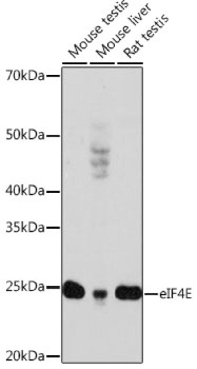 Anti-eIF4E antibody produced in rabbit