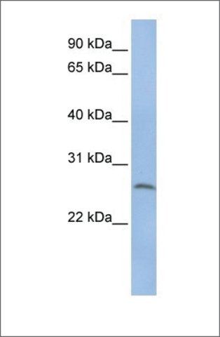 Anti-ELA1 antibody produced in rabbit