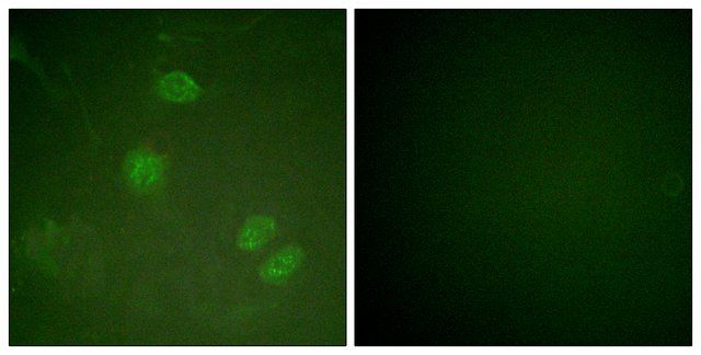 Anti-ELK3 antibody produced in rabbit