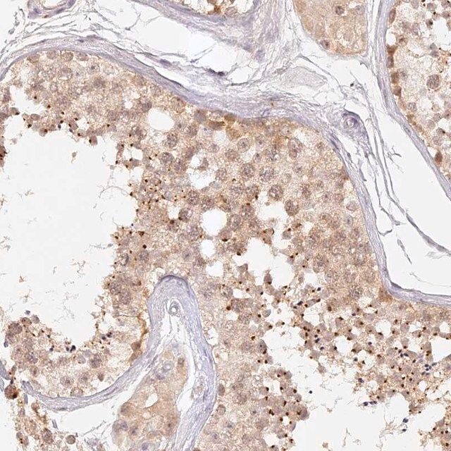 Anti-ELL3 antibody produced in rabbit