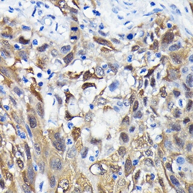 Anti-eIF4EBP1 antibody produced in rabbit