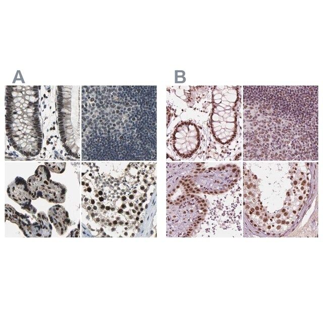 Anti-ELF2 antibody produced in rabbit