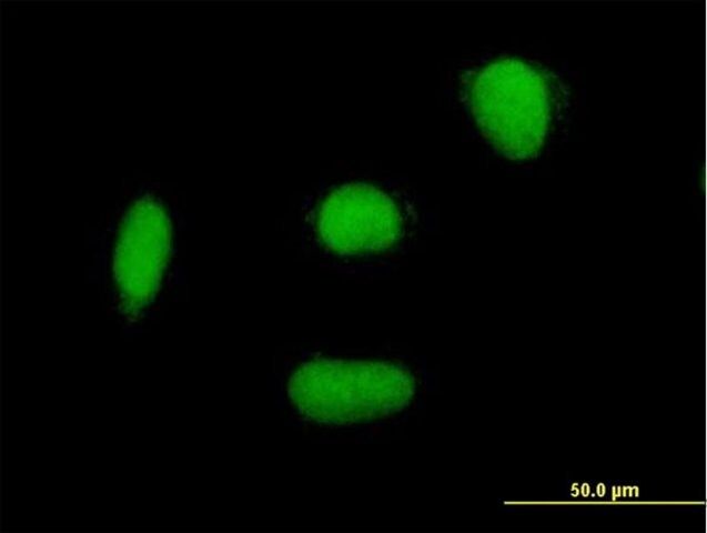 Anti-ELAC2 antibody produced in mouse