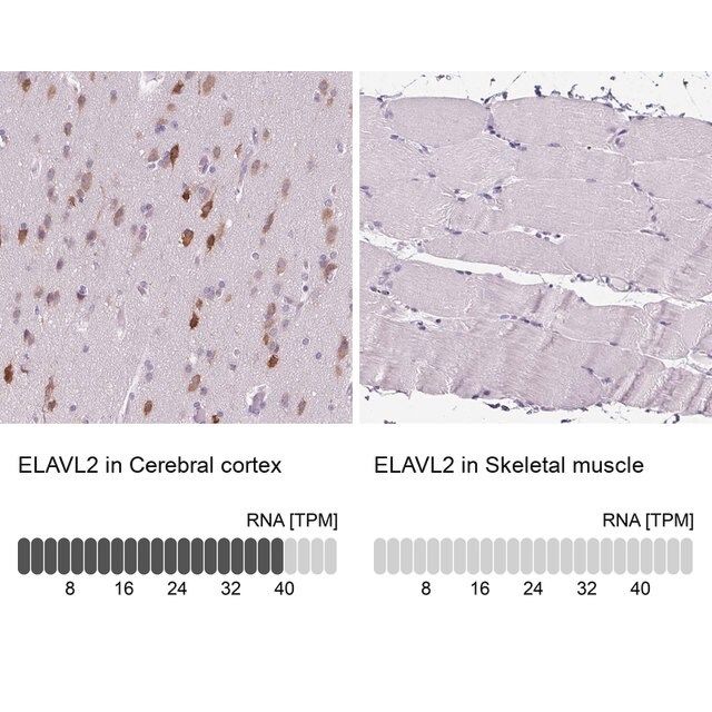 Anti-ELAVL2 antibody produced in rabbit