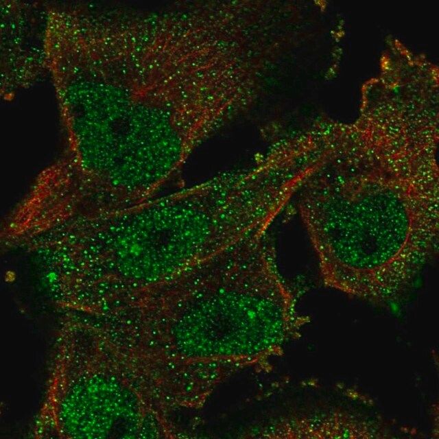 Anti-ELAVL4 antibody produced in rabbit