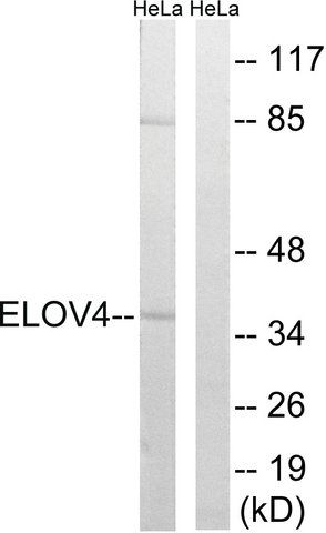 Anti-ELOVL4 antibody produced in rabbit