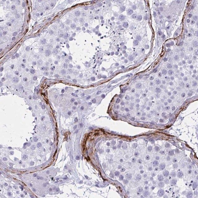 Anti-ELN antibody produced in rabbit