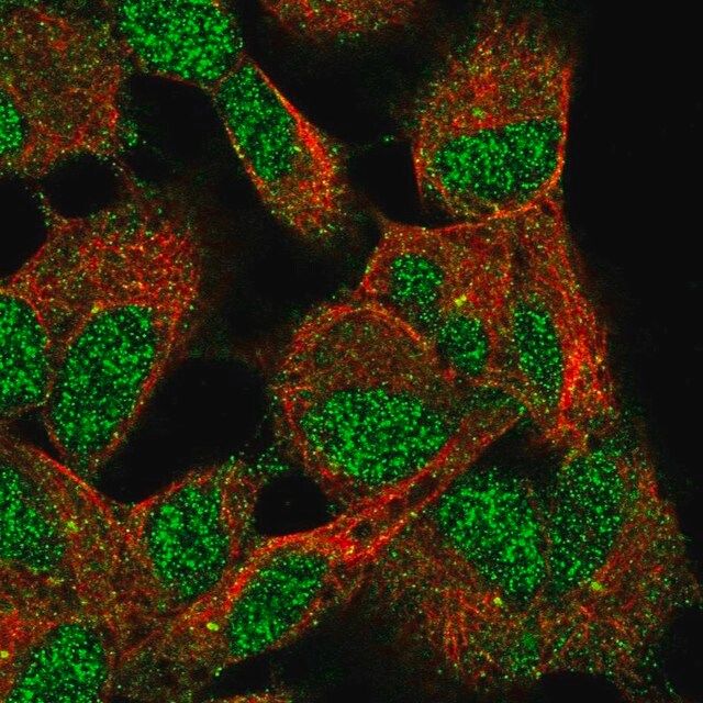 Anti-ELP6 antibody produced in rabbit