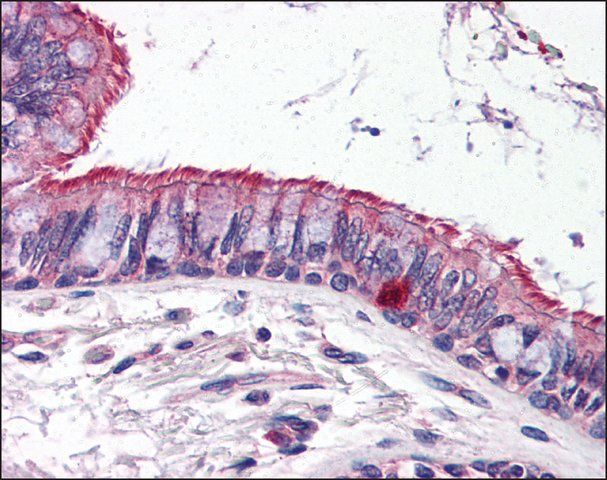 Anti-ELOVL6 antibody produced in rabbit