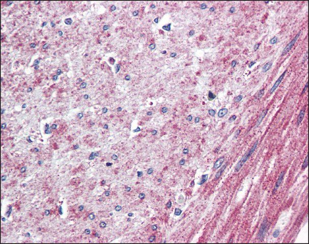 Anti-ELTD1 antibody produced in rabbit