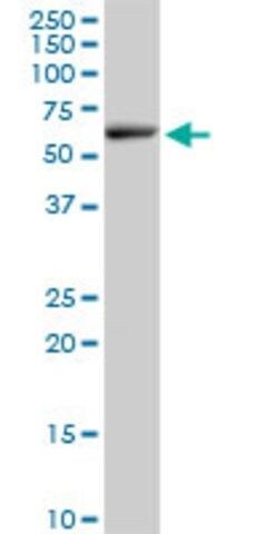 Anti-ELP3 antibody produced in mouse