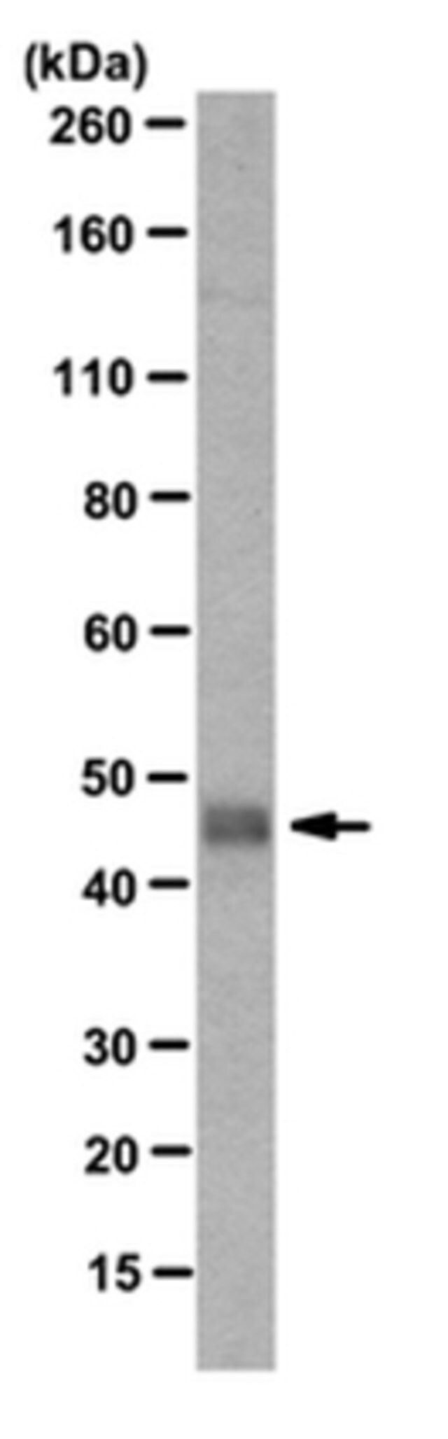 Anti-EMAPII Antibody, clone M7/1, (Preservat ive free)