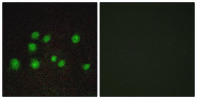 Anti-ELOA2 antibody produced in rabbit