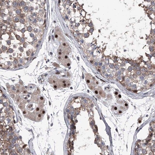 Anti-ELK4 antibody produced in rabbit