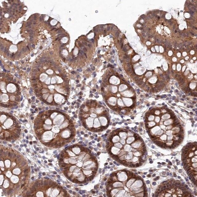 Anti-ELOVL6 antibody produced in rabbit