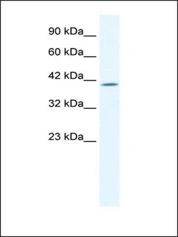 Anti-ELK4 antibody produced in rabbit